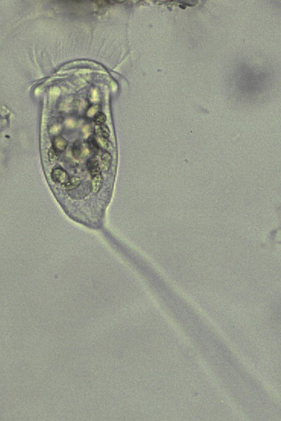 Vorticella