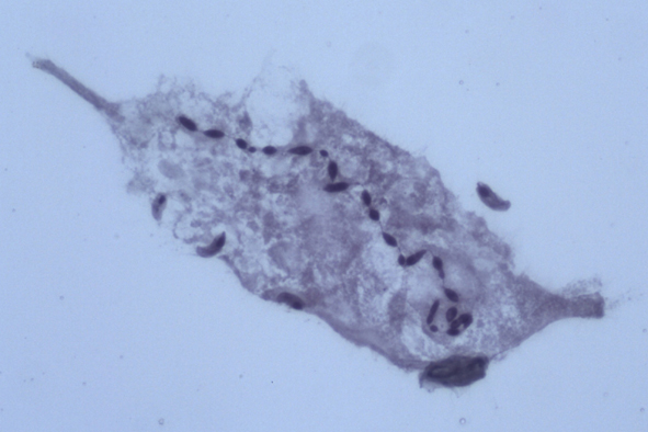 Spirostomum