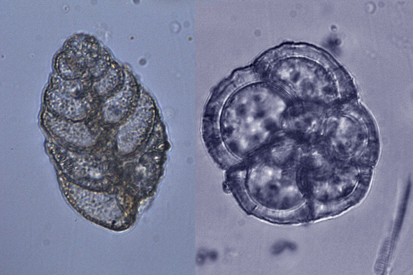 http://www.zoologie.frasma.cz/mmp%200103%20Rhizaria/Obr.%20010301.schranky%20dirkonoscu.OS_zmensenina.jpg