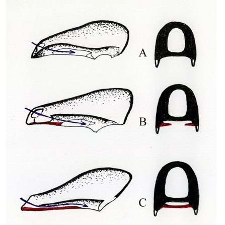 vývoj sekundárního patra